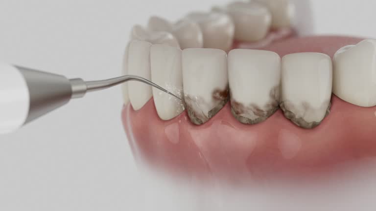 Reliable Dental Implants contractor in Metzger, OR by Smile Center Dentistry